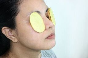 përdorimi i patateve për përtëritje rreth syve