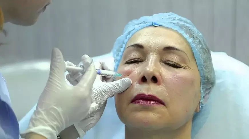 bioreforcement për rinovimin e fytyrës